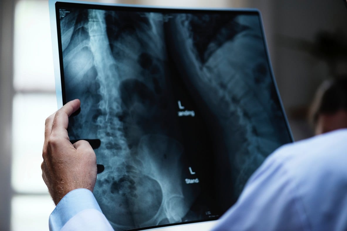 injury xray